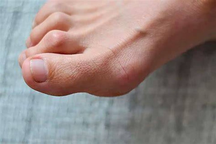 How can I stop my toes from hurting at night?