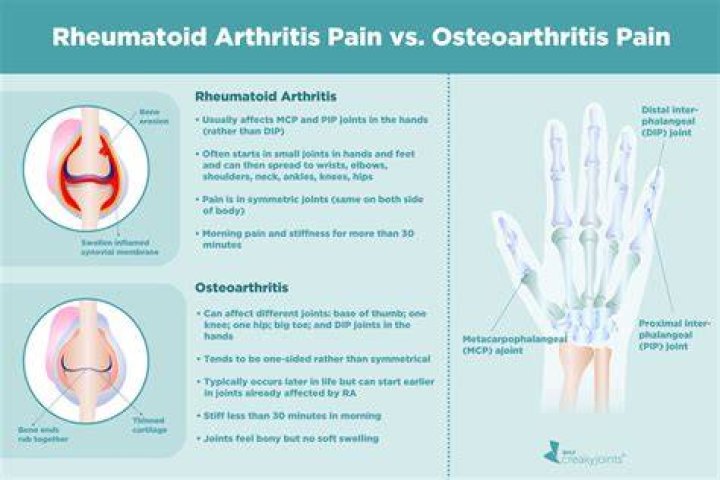 How can I tell if I have osteoarthritis or rheumatoid arthritis?