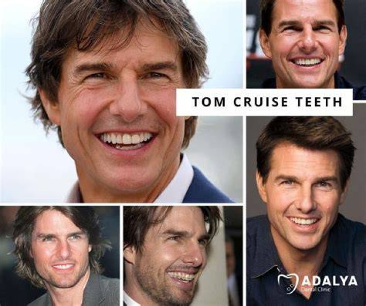 How did John Finlay get his teeth fixed?