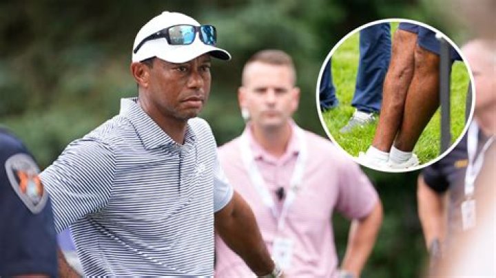 How did Tiger Woods come out in the Masters?