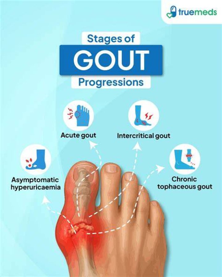 How do I know if I have gout in my finger?