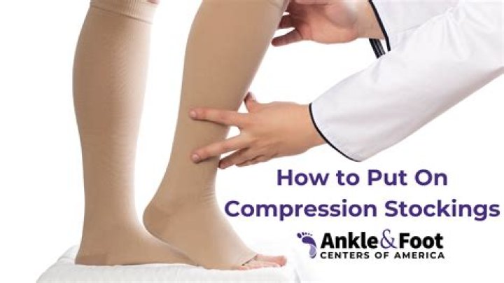How do I know if I need compression stockings?