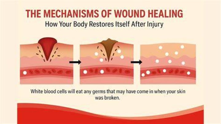 How do I make resin heal faster?