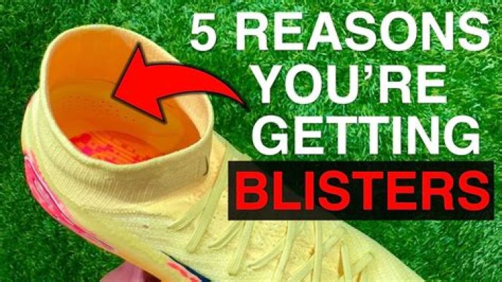 How do you break in boots that give you blisters?