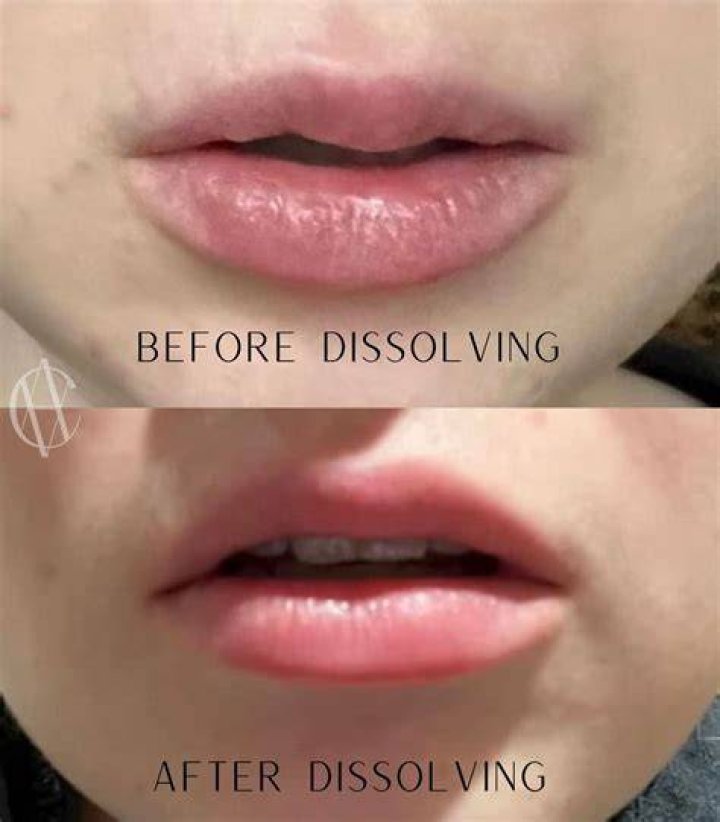 How do you dissolve pigment ink?