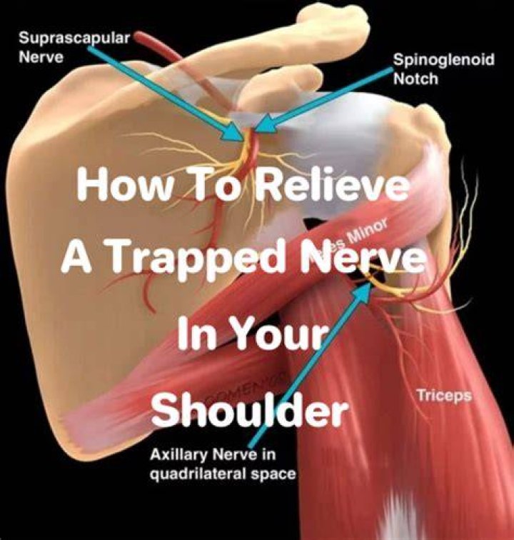 How do you fix nerve pain in your shoulder?