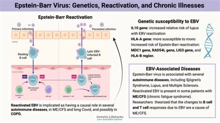 How do you get rid of chronic Epstein-Barr virus?