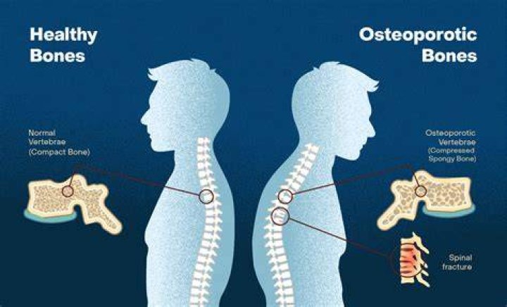 How do you increase osteocalcin levels?
