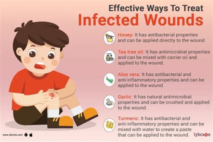 How do you know if an infection is getting worse?