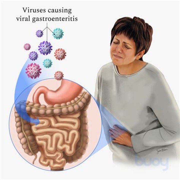 How do you know if gastroenteritis is viral or bacterial?