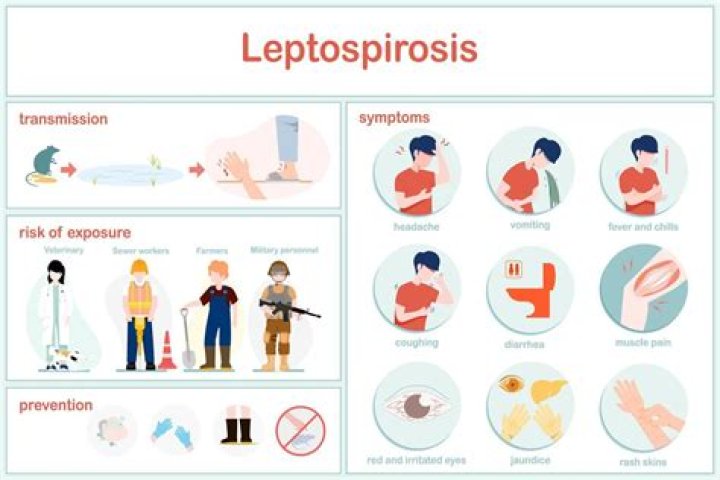 How do you prevent leptospirosis after exposure?