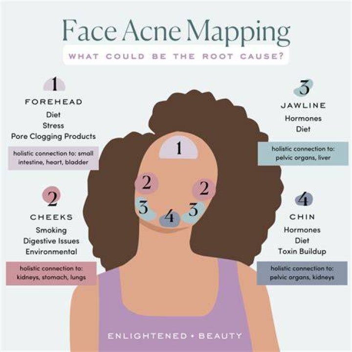 How do you speed up acne clearing?