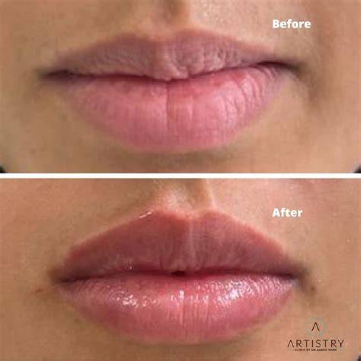 How do you stop fillers from showing in paint?