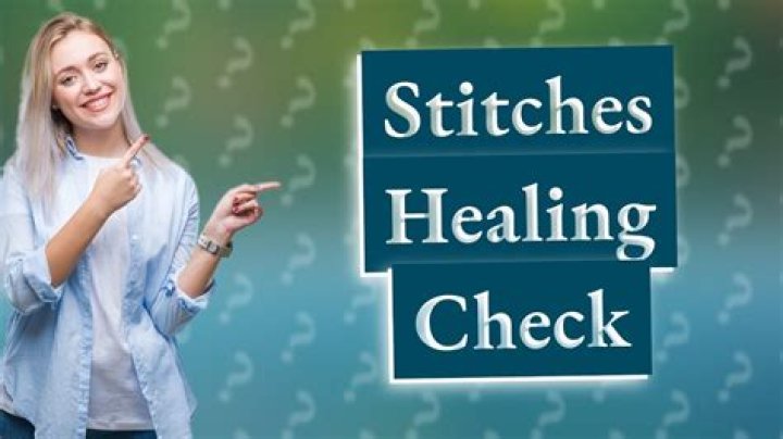 How do you tell if stitches are healing properly?