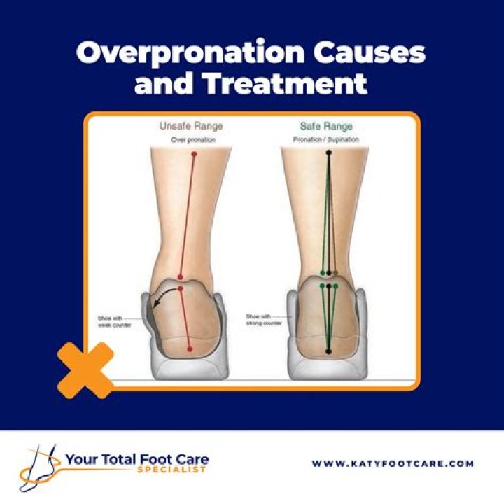 How do you test for Underpronation?