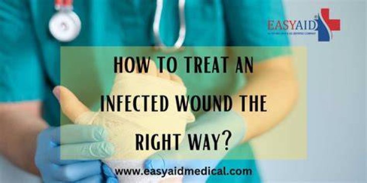 How do you treat a smelly wound?