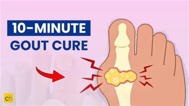 How do you treat gout in the thumb?
