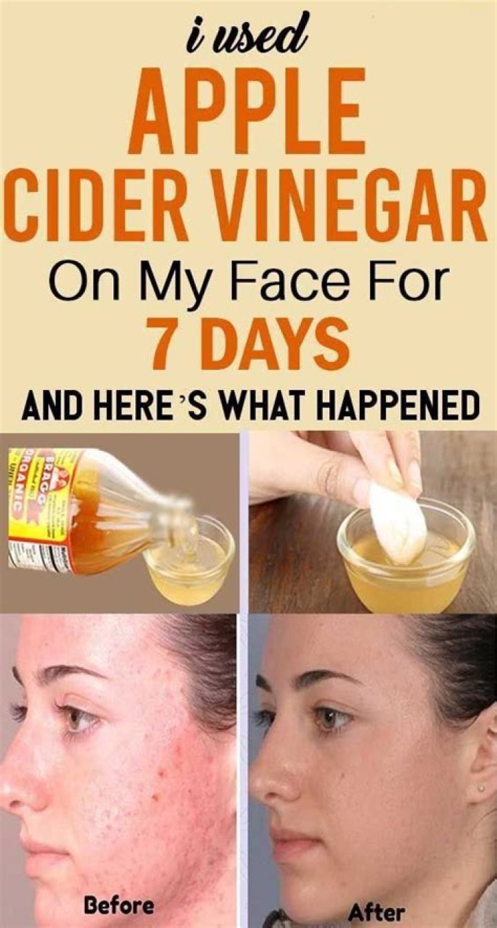 How do you use apple cider vinegar on your face overnight?