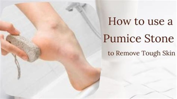 How does a pumice stone work?