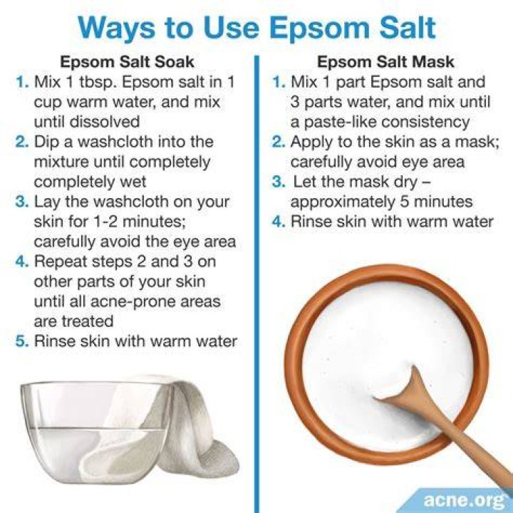 How does Epsom salt get rid of tree stumps?