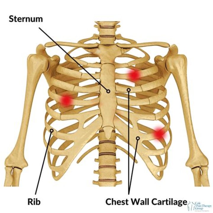 How long can chest wall inflammation last?
