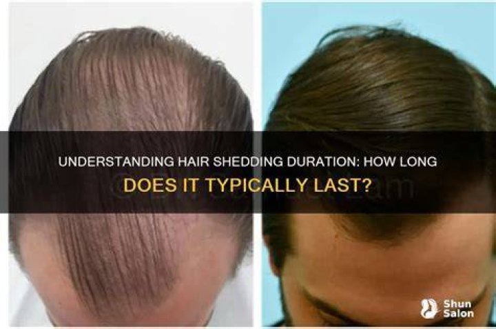 How long can hair shedding last?