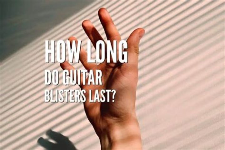 How long do blisters last on finger?