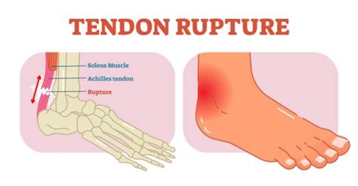How long does a strained tendon take to heal?