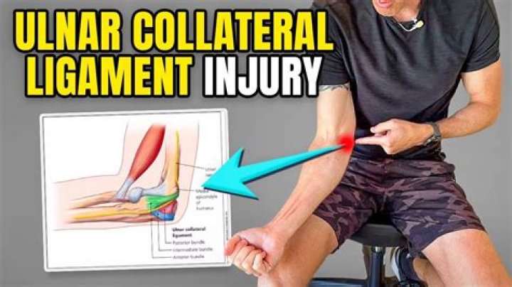 How long does a torn UCL take to heal?