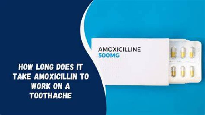 How long does it take amoxicillin to work on a toothache?