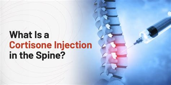 How long does it take for a cortisone shot to start working?