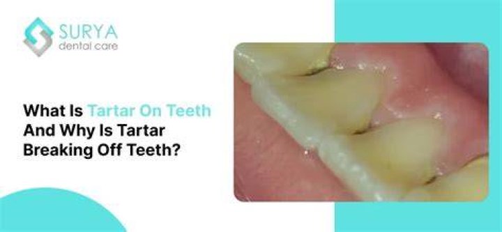 How long does it take for tartar to damage your teeth?