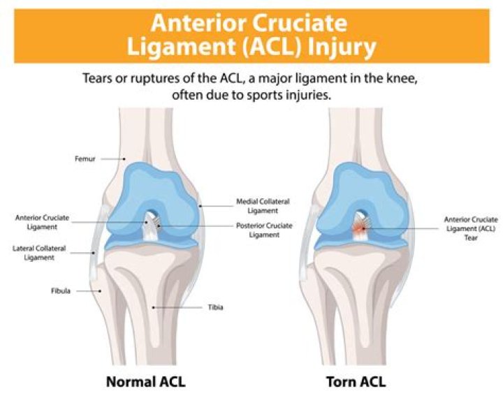 How long does it take to install body lift?