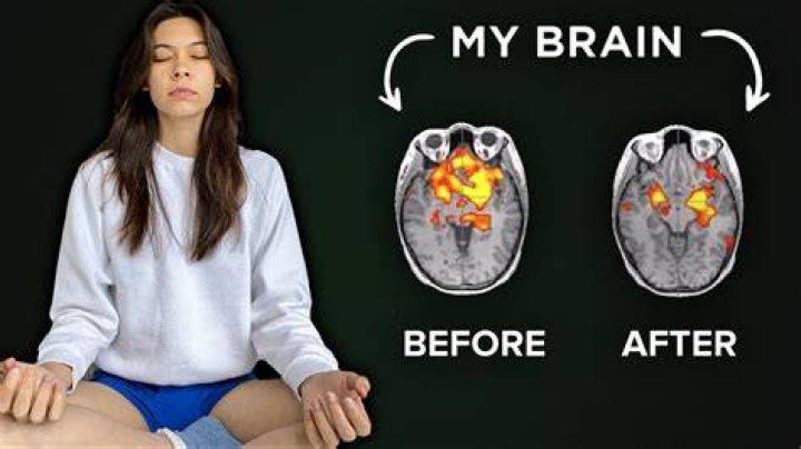 How long does meditation take to change your brain?