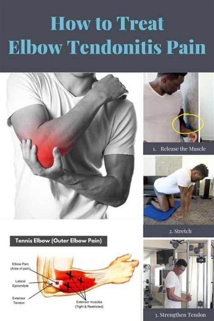 How long does tendonitis in the elbow take to heal?