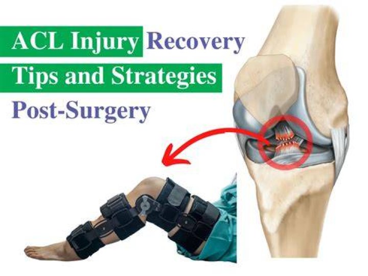 How long is ACL recovery?