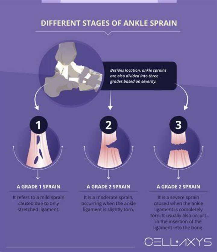 How long until you can walk on a Grade 3 ankle sprain?