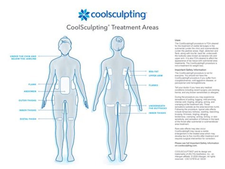 How many CoolSculpting treatments are needed for thighs?