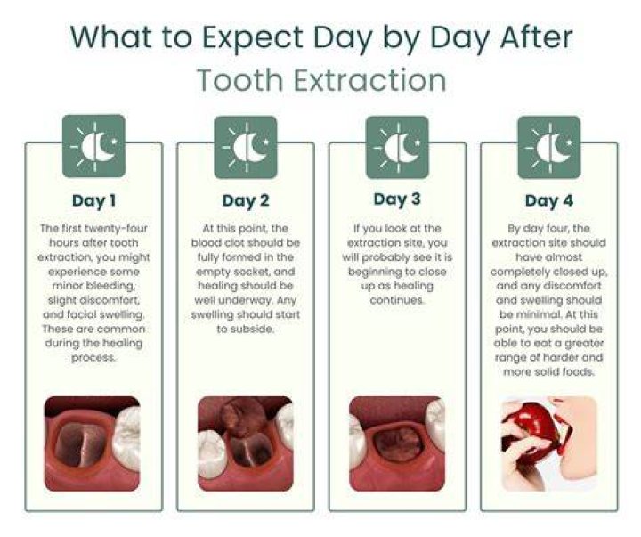 How many days does it take for a tooth extraction to heal?