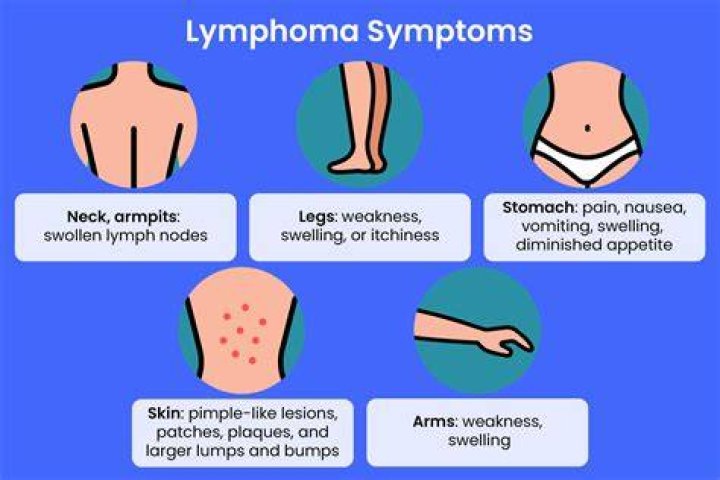 How many rounds of chemo do you need for lymphoma?