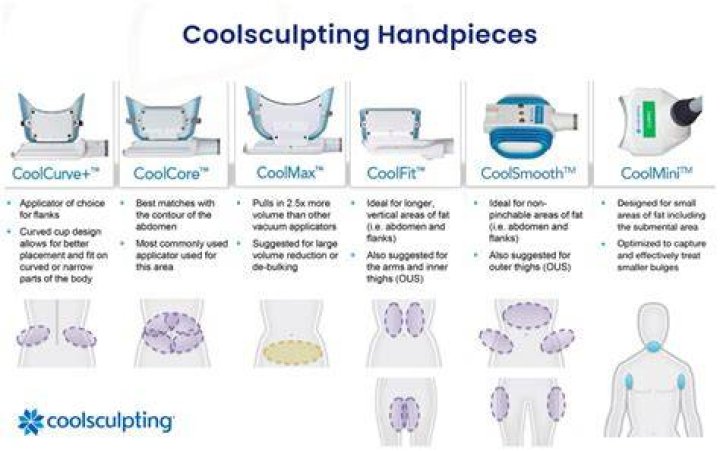 How many times can you get CoolSculpting?