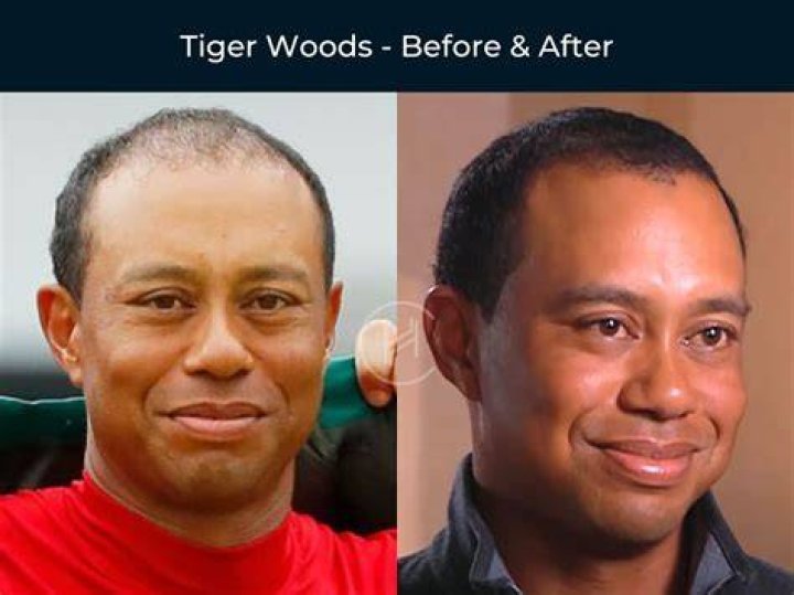 How much did Tiger Woods make Masters 2022?