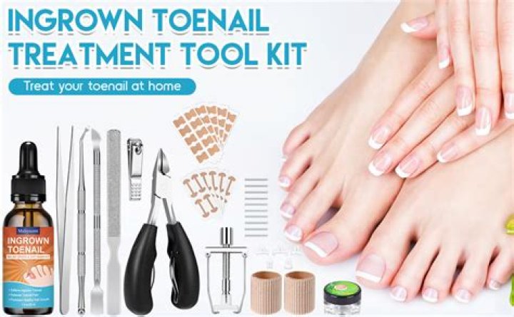 How much is it to get a ingrown toenail removed?