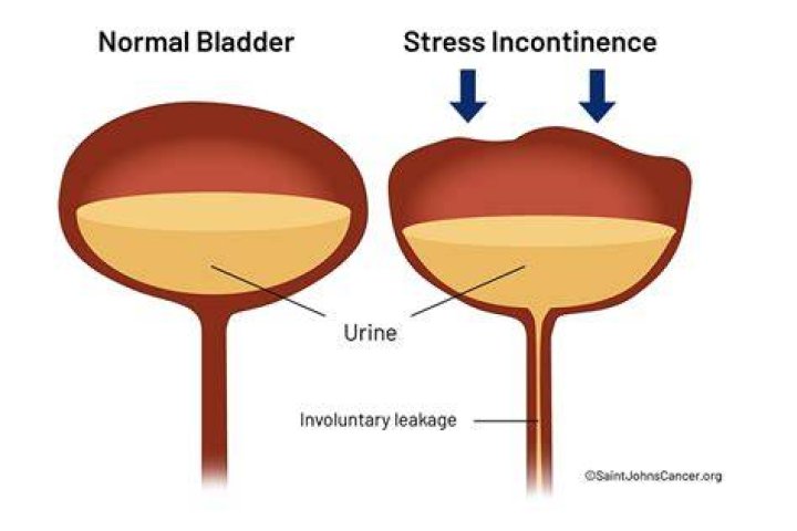 How much urine should be left in bladder after voiding?