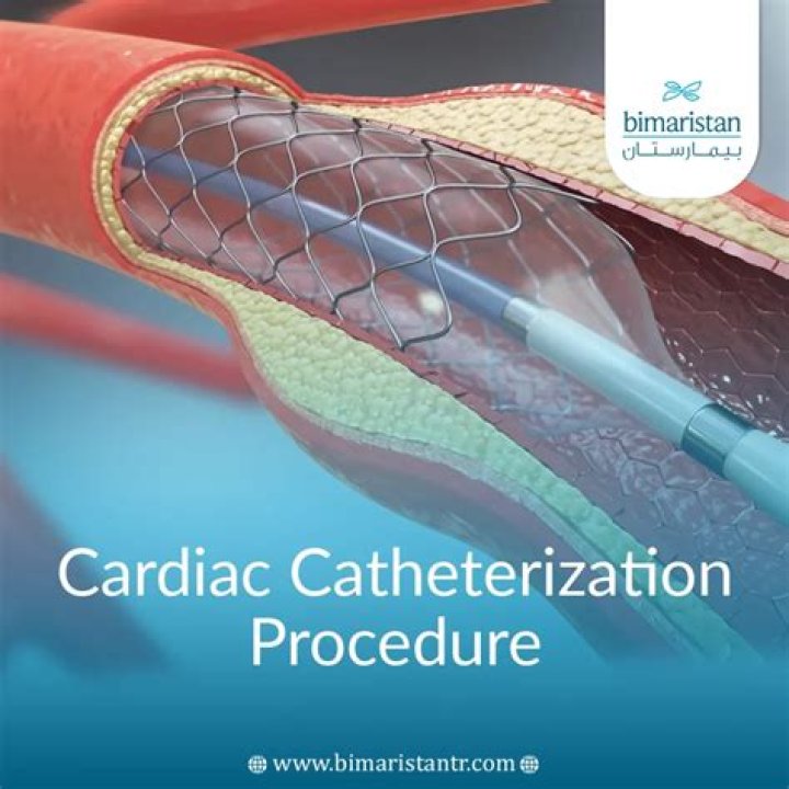 How painful is a heart catheterization?