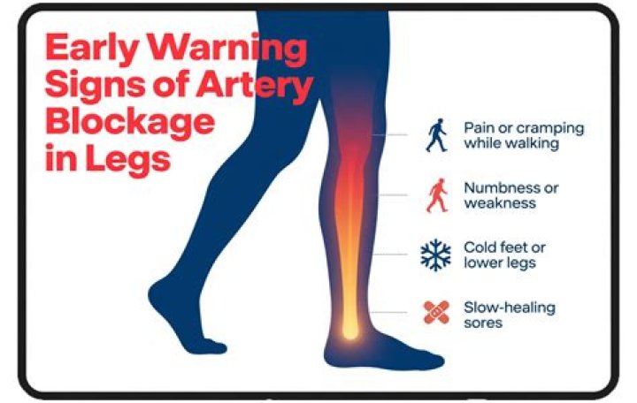 How serious is blockage in legs?