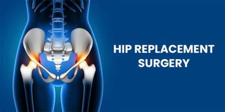 How successful is hip replacement surgery?