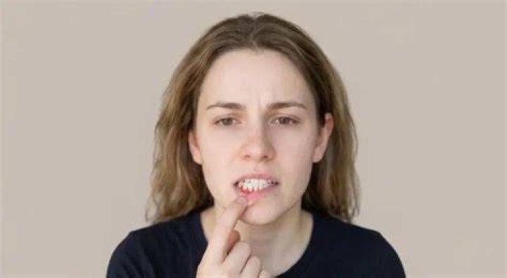 How urgent is a root canal?