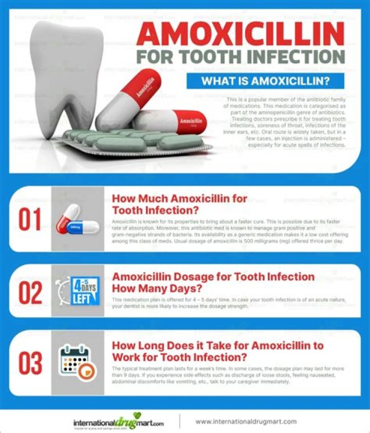 Is 5 days of amoxicillin enough for tooth infection?