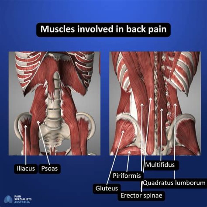 Is a muscle back a blade?